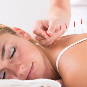 Acupuncture in Grand Junction CO